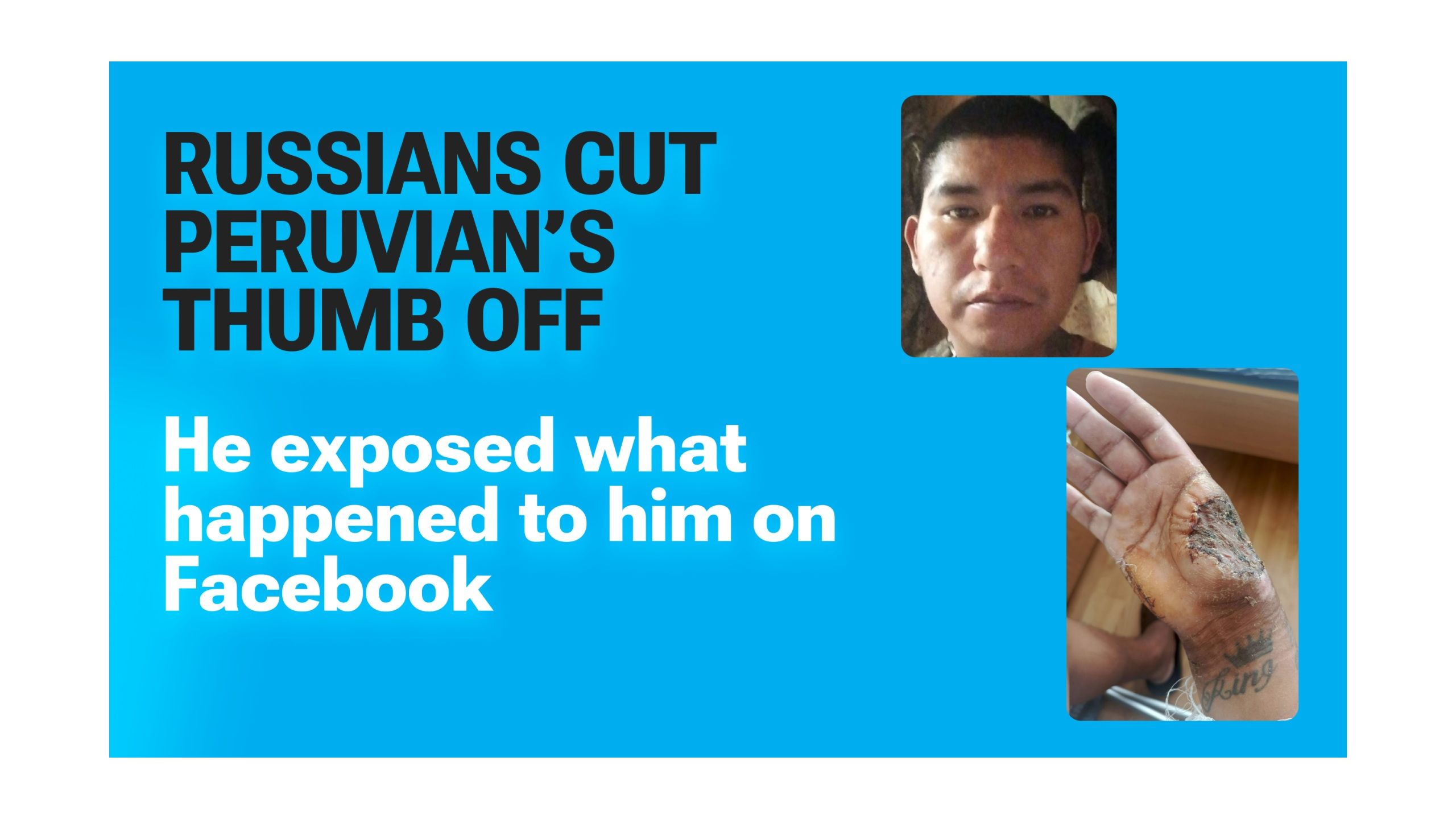 Peruvian Recruit Says His Thumb Was Cut Off for Refusing to Hand Over His Bank Account