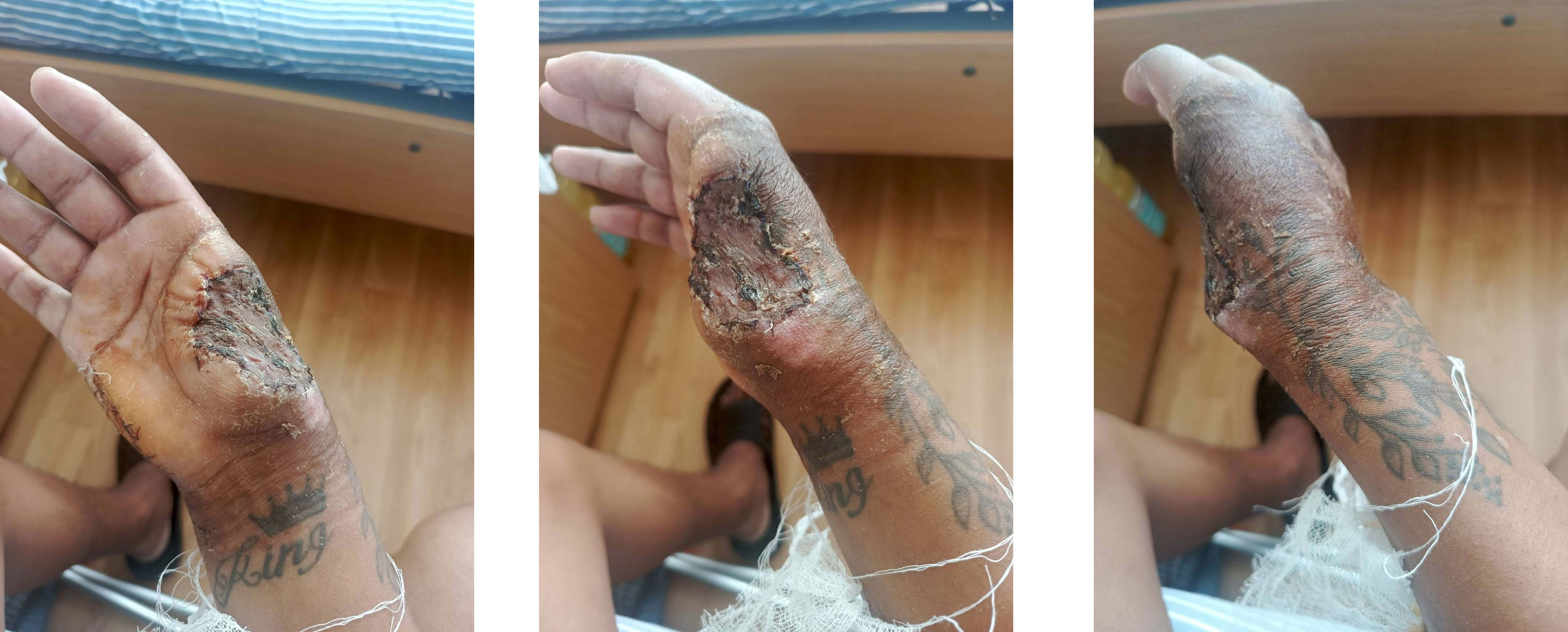 thumb.jpg